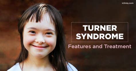 Turner Syndrome Images