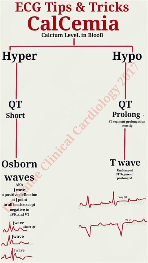 Hypocalcemia Ekg