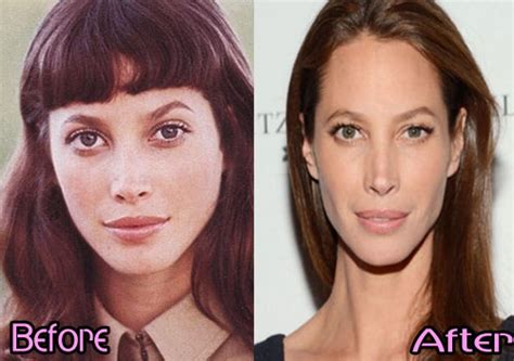 christy turlington nose job - Christy Turlington