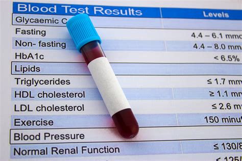 Obsoleting Cholesterol Testing — Stanford Blood Center