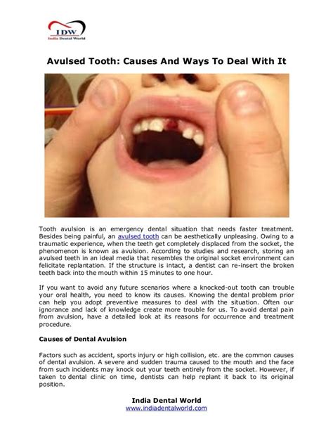 Avulsed Tooth: Causes And Ways To Deal With It