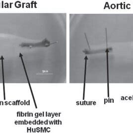 Vascular grafts. Representation of the final vascular graft products in ...