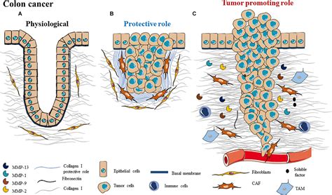 Frontiers | A Complex and Evolutive Character: Two Face Aspects of ECM in Tumor Progression