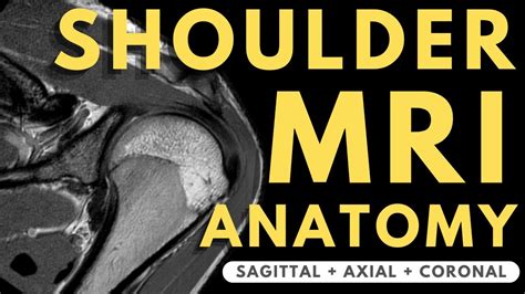 Shoulder Joint Anatomy Mri