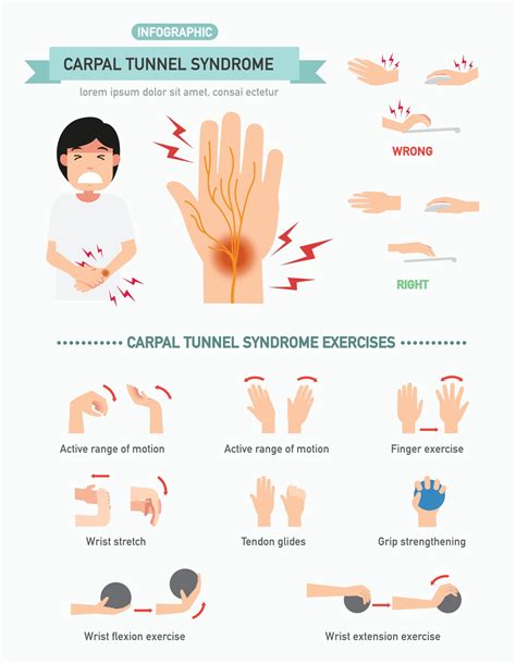 infografía del síndrome del túnel carpiano, ilustración. 3239775 Vector en Vecteezy