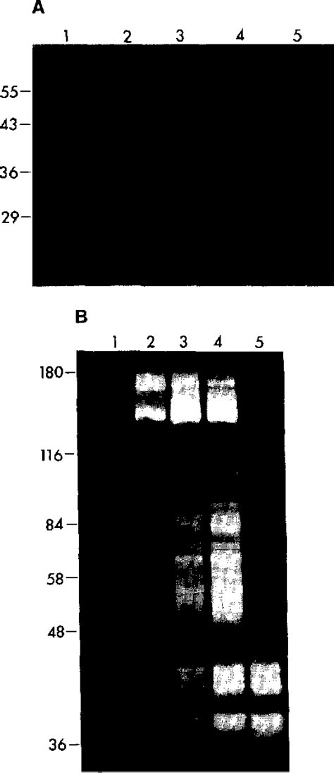 Figure 1 from Extracellular proteolytic activation of bacteriolytic peptidoglycan hydrolases of ...