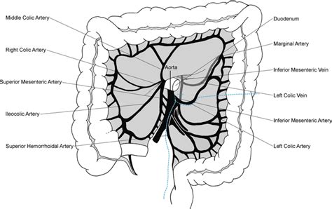 Open Technique for Low Anterior Resection | Abdominal Key