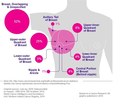 WMNF | Breast Cancer Info By Cancer Research UK - WMNF