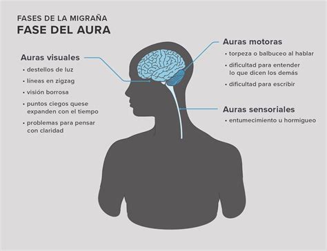 análisis Inconsciente Más lejano dolor de ojo por migraña Es decir ...