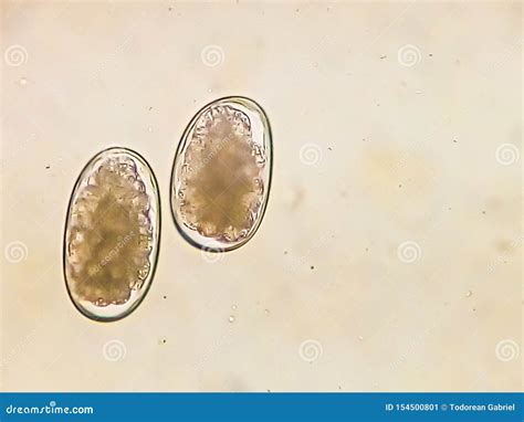 Dog Hookworm In Stool