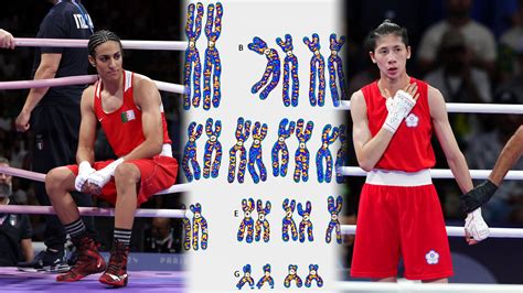 Olympic boxing controversy: Does Imane Khelif have XY chromosome? – NBC 5 Dallas-Fort Worth