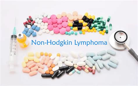 4 Stages of Non-Hodgkin's Lymphoma: Clarity Amidst Complexity