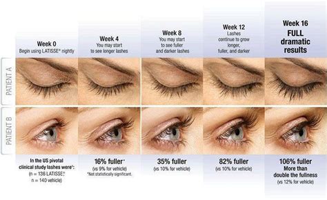 Latisse Eyelash Treatment: Grow Thick Long Eyelashes