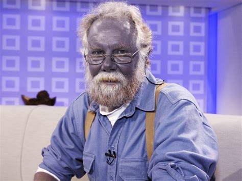 Is It Possible That People Have Blue Skin? | AidWiki