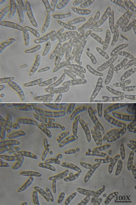 Identification of Fusarium spp. under compound microscope. In vitro... | Download Scientific Diagram