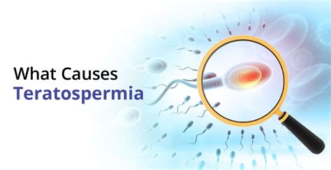 What is Teratospermia, Causes & Treatment| Birla Fertility & IVF