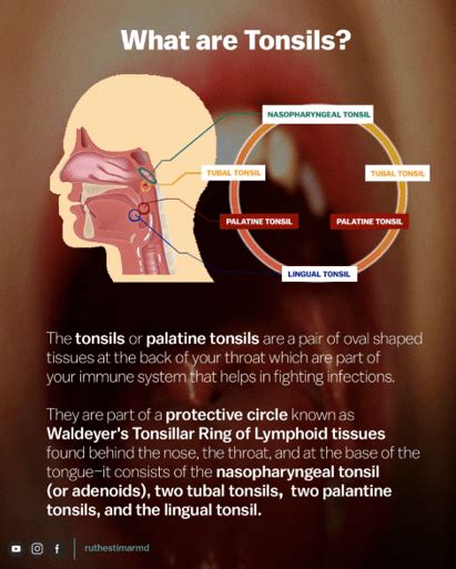 Did You Know That Your Tonsil Health Can Affect Your Heart - Dr. Ruth ...