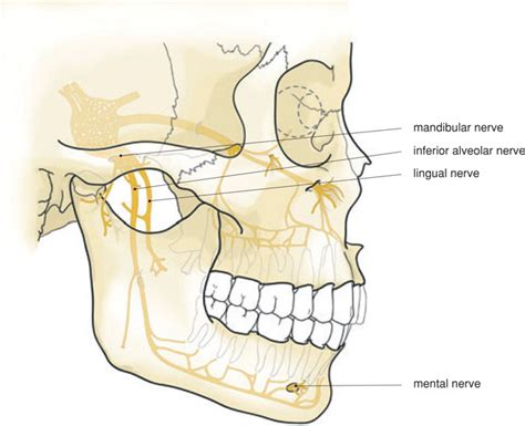 6 Local anaesthesia in the lower jaw | Pocket Dentistry