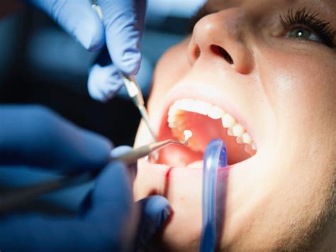 Dental Restoration: Sedalia, MO | Dentist in Sedalia , MO: Teeth Cleaning, Root Canals, Fillings