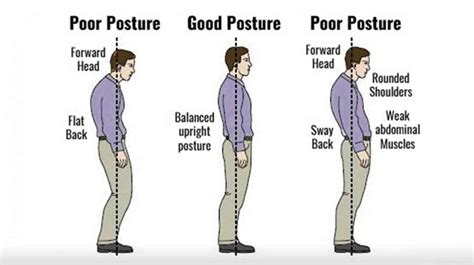 Flat Back Syndrome Causes, Symptoms, Diagnosis and Treatment