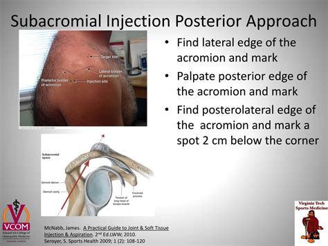 Subacromial Bursa Anatomy