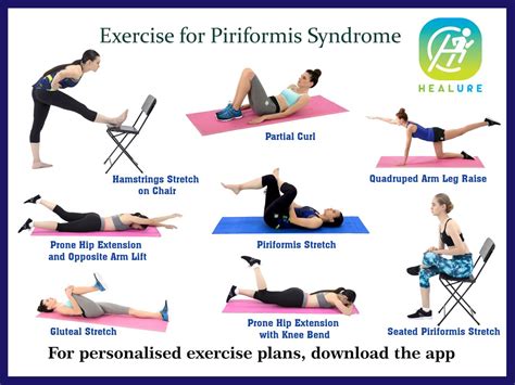 Piriformis Syndrome Recovery Exercises Piriformis Syndrome | My XXX Hot ...