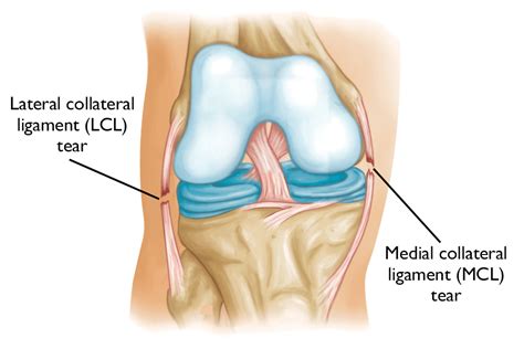 Mending Knee Injuries: A Couple of Supportive Activities - VU Education