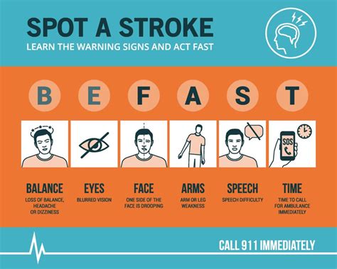 When it Comes to Stroke It's Important to Be FAST