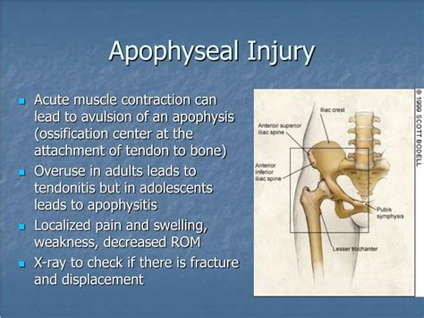 PPT - Anterior Hip Pain PowerPoint Presentation, free download - ID:158411