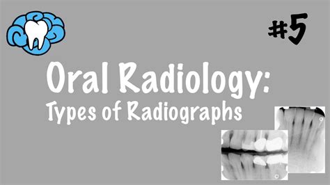 Oral Radiology | Types of Radiographs | INBDE, ADAT - YouTube