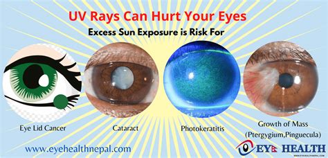 What Are The Ultraviolet Rays? Beneficial And Harmful Effects Of UV Rays - Eye Health Nepal