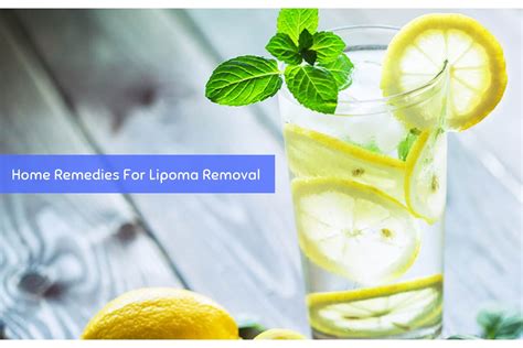 Lipoma Removal: Home Remedies To Avoid A Surgery