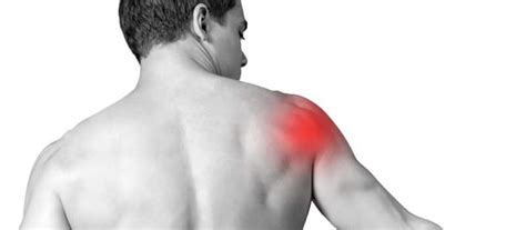 Rotator Cuff Injury, Symptoms, Treatment by Lubbock Sports Medicine