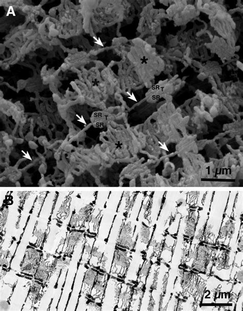 T tubules are continuous, but jSR is not. (A) A slow fiber from fish... | Download Scientific ...