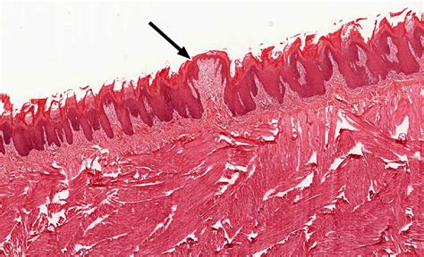 Oral Cavity | histology