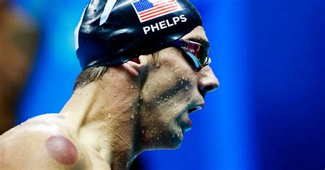 Michael Phelps Cupping Marks Details, Rio Olympics 2016