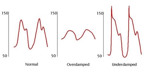 art line waveform whip - your life