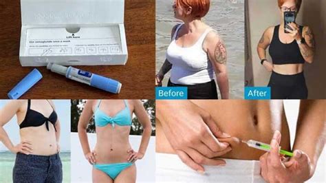 Ozempic Weight Loss Before and After Pictures - Best Health Insider