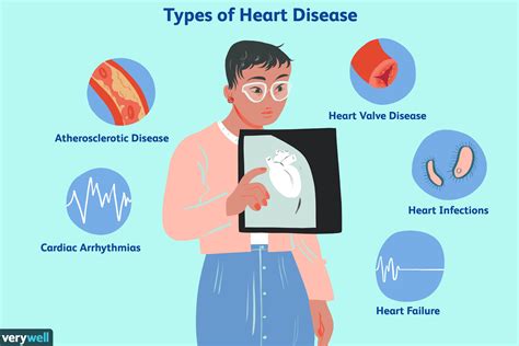 Heart Disease: Overview and More