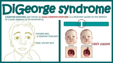 Anatomic defects and immunodeficiencies - Pharmacy Gyan