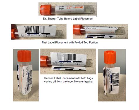 Blood Bank Specimens Specimen Labeling - vrogue.co