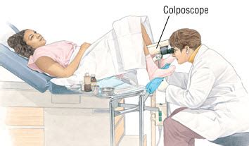 Colposcopy - Tidke Hospital