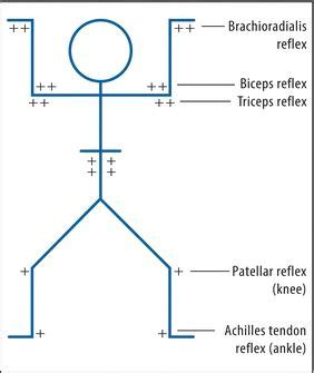 Deep Tendon Reflex Chart | Labb by AG