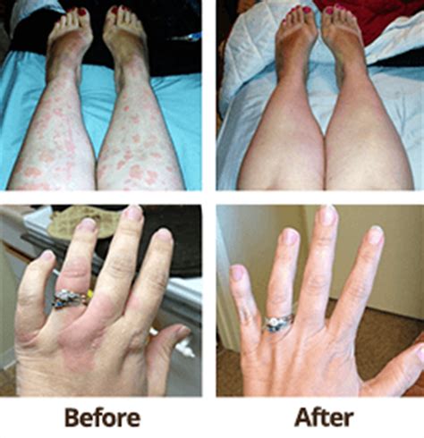 Itchy Skin Rash After Surgery Causes Diagnosis Treatment