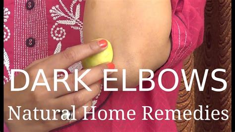 Dark Elbows - Natural Home Remedies - YouTube