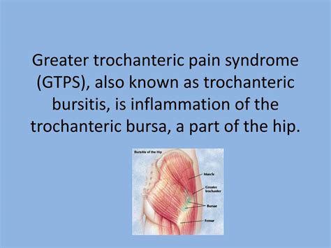 PPT - Greater trochanteric pain syndrome (GTPS), also known as ...