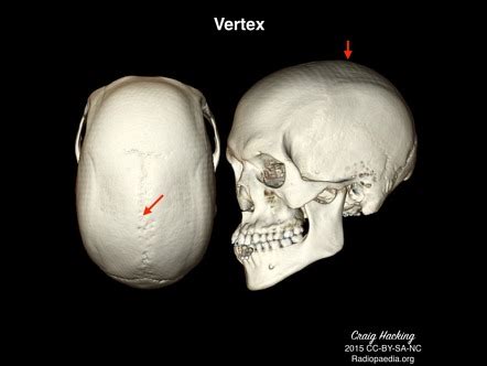 Vertex Of Skull