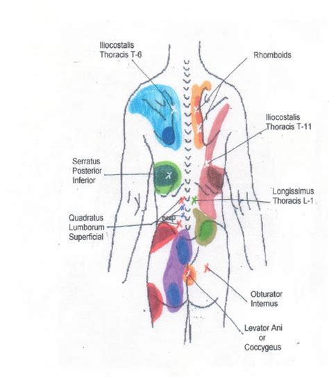 Neck to Buttocks, Front and Rear, Trigger Point Chart 4 © Copyright American Academy of Manual ...