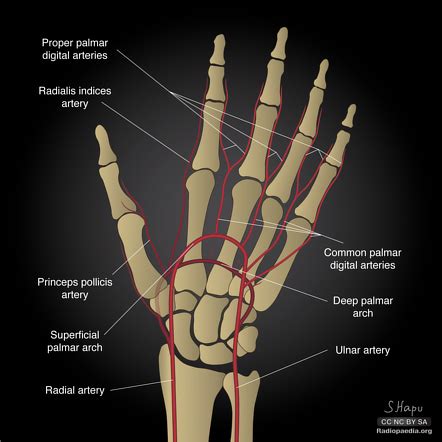 Princeps pollicis artery | Radiology Reference Article | Radiopaedia.org