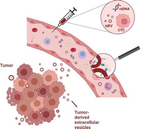 Clinical applications and challenges in the field of extracellular vesicles